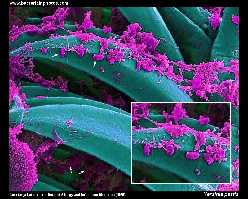 Yersinia Pestis SEM
