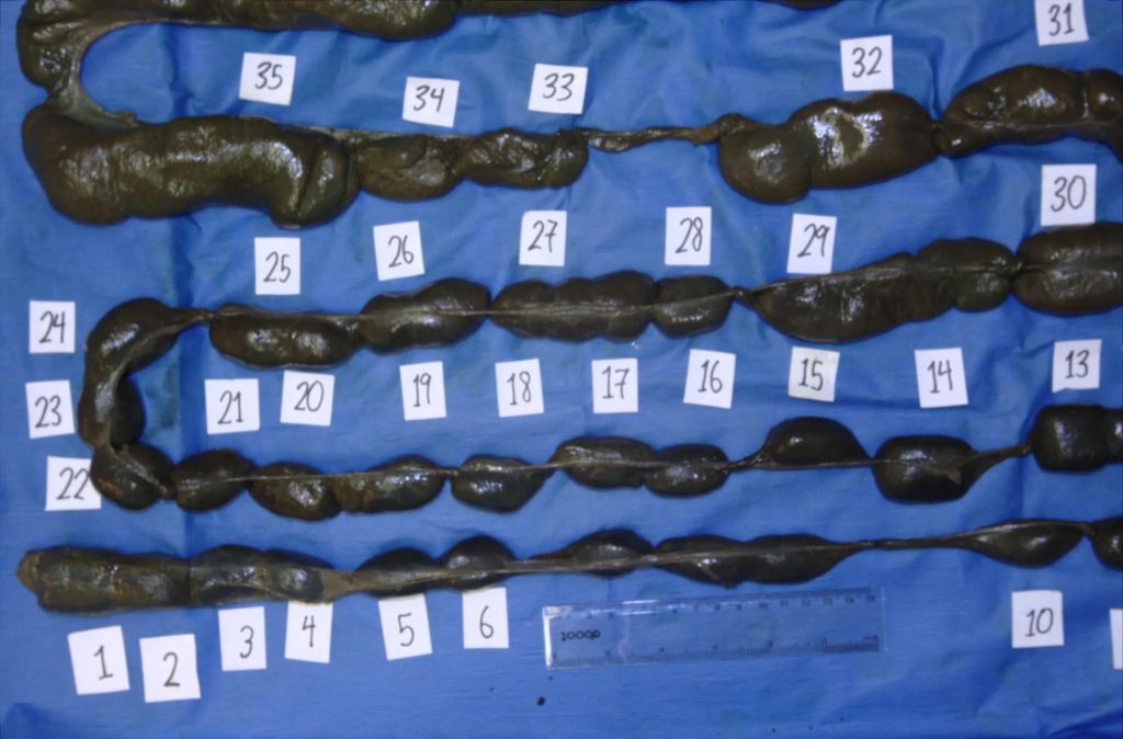 Intestino Wombat