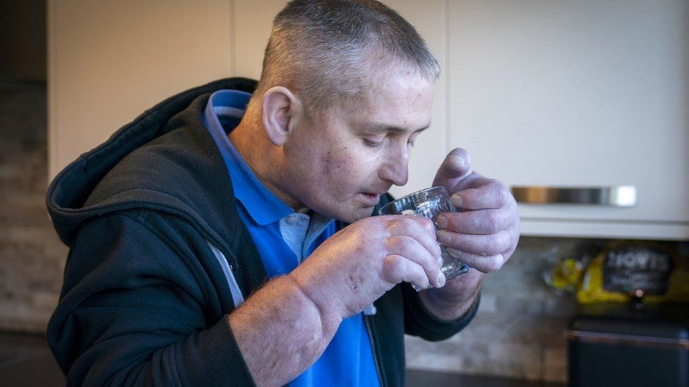 Steven Gallagher tomando agua luego del trasplante de dos manos