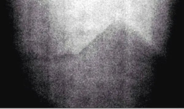 Fotos espeluznantes que siguen sin explicación