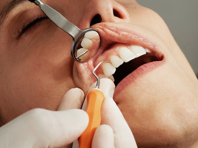 Cómo eliminar el sarro de los dientes: La guía definitiva para deshacerte de este problema