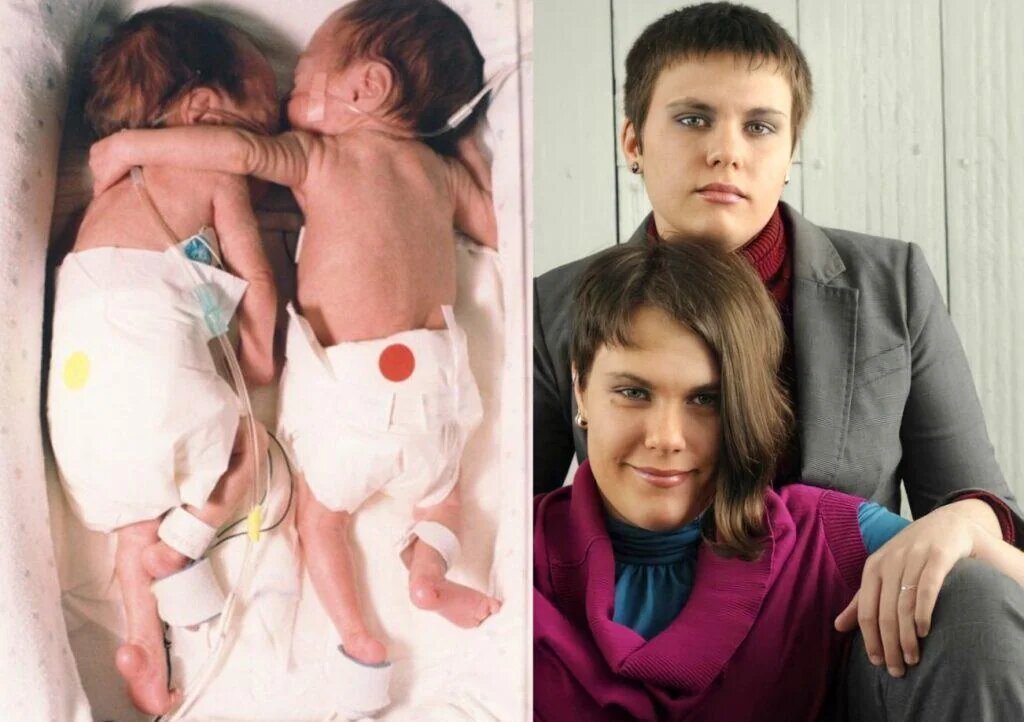 The Rescue Hug: The Image That Changed the History of Medicine