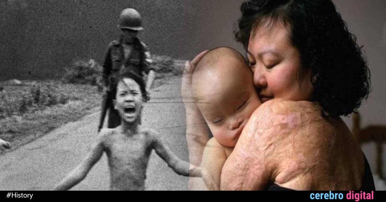 Kim Phuc, the "Napalm Girl": one of the most haunting images of the war