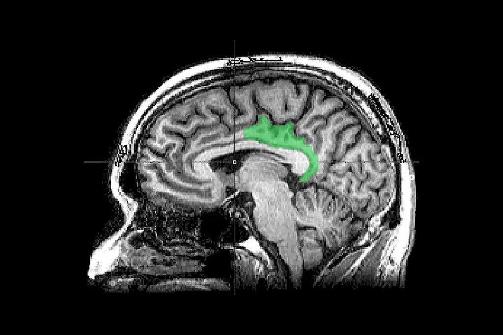 Un estudio del cerebro sugiere que los recuerdos traumáticos son procesados de forma diferente