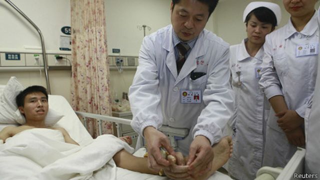 Transplanting a Hand to the Ankle to Save It: One of the Most Astonishing Medical Cases