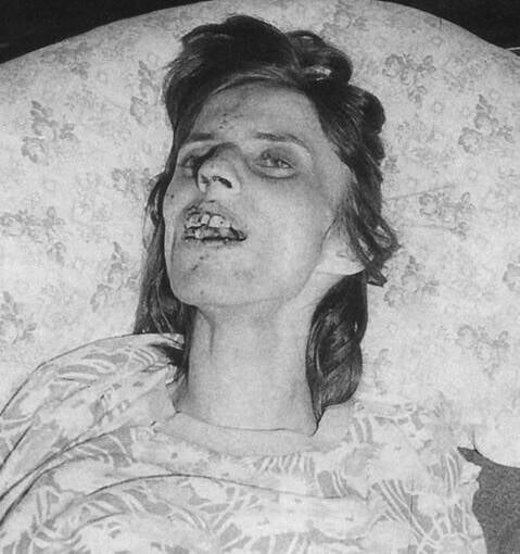 El grito de una joven poseída: El fatídico caso de Anneliese Michel