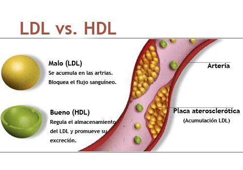 La demencia y podría relacionarse con el “colesterol bueno”, según nueva investigación