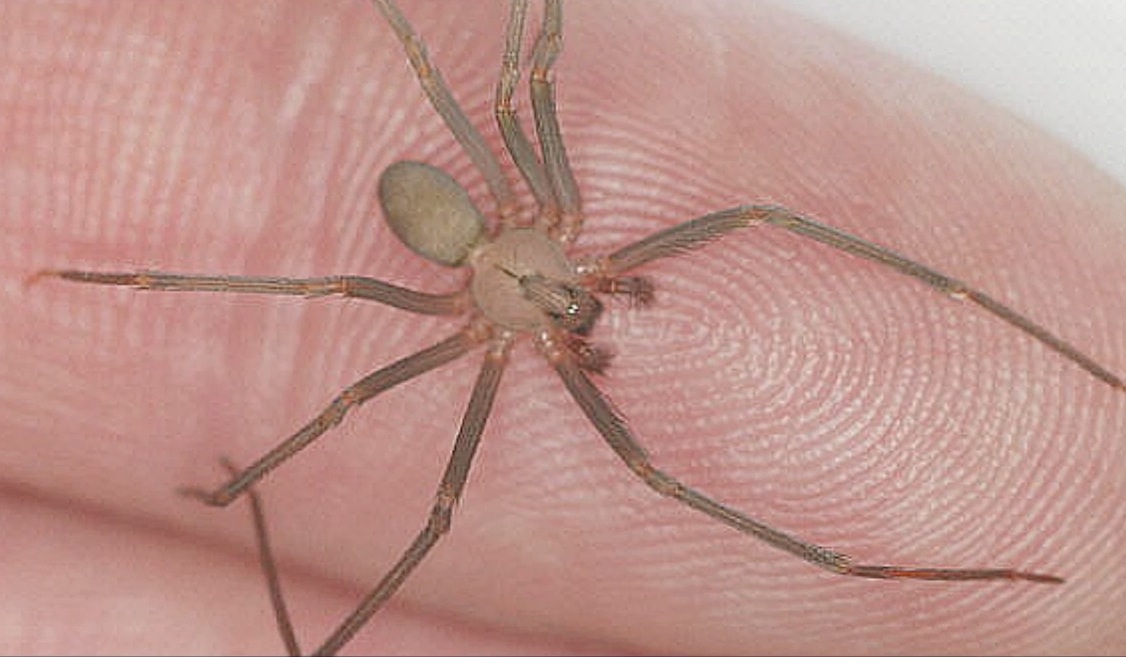que hacer ante una picadura de araña violinista