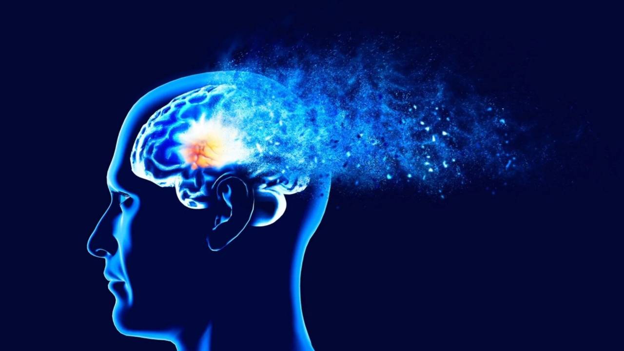El Alzheimer se transmitió a través un procedimiento médico antiguo, reveló estudio