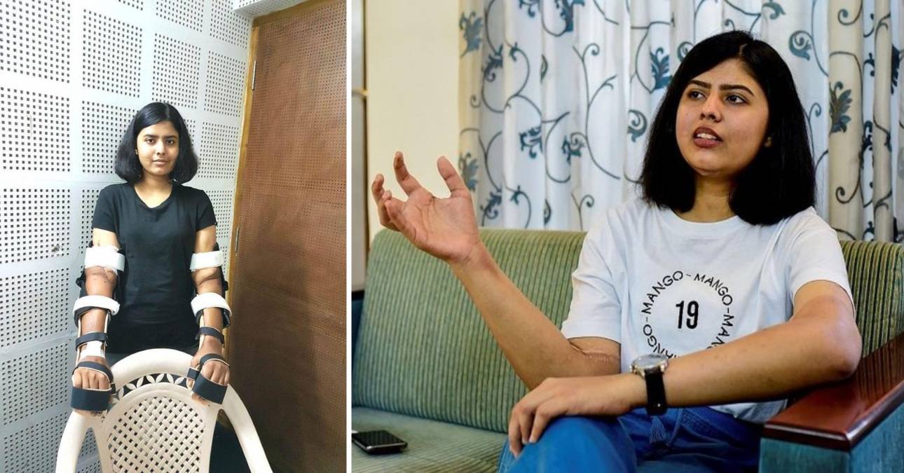 The case of Shreya Siddanagowda: A man's arm transplant adapting to her female body