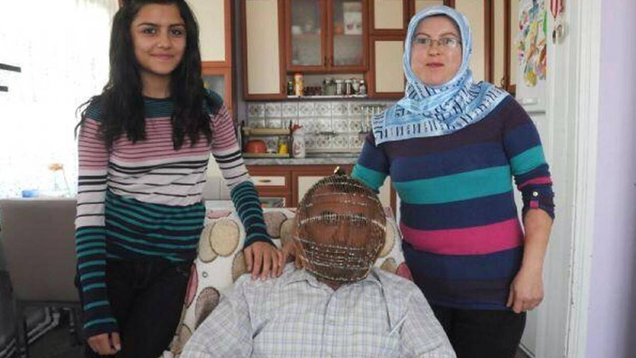 EncerrĂ³ su cabeza en una jaula para dejar de fumar