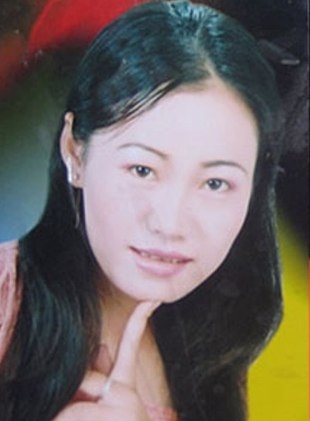 Nguyen Thi Phuong: El extraño caso de envejecimiento acelerado