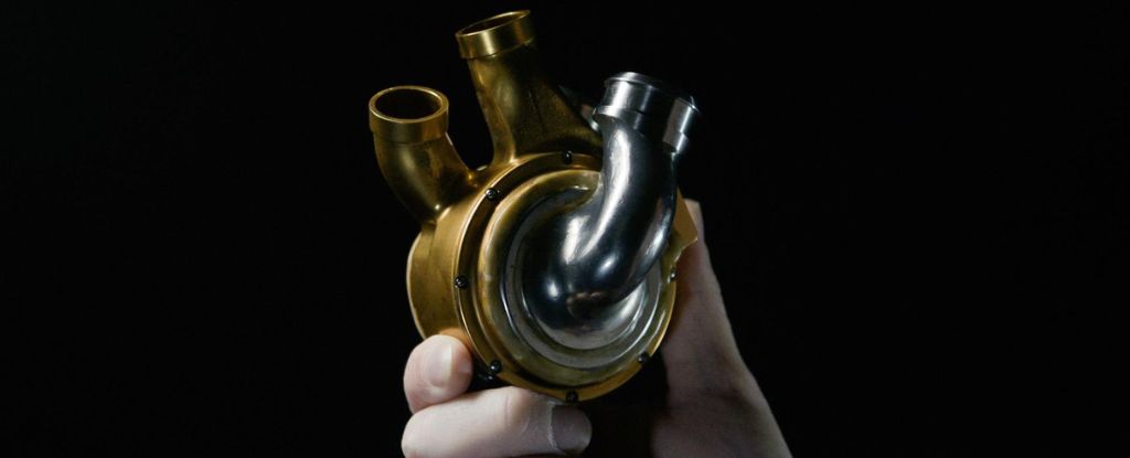 Primer implante mundial de un corazón de titanio que aprovecha la tecnología de levitación magnética