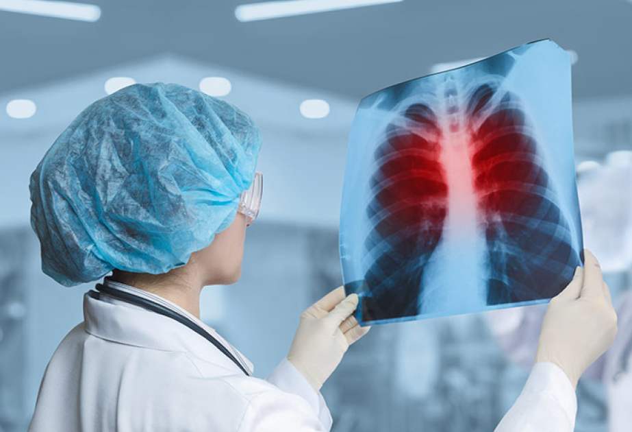 Nueva enfermedad infecciosa mortal en el mundo, y no es el COVID
