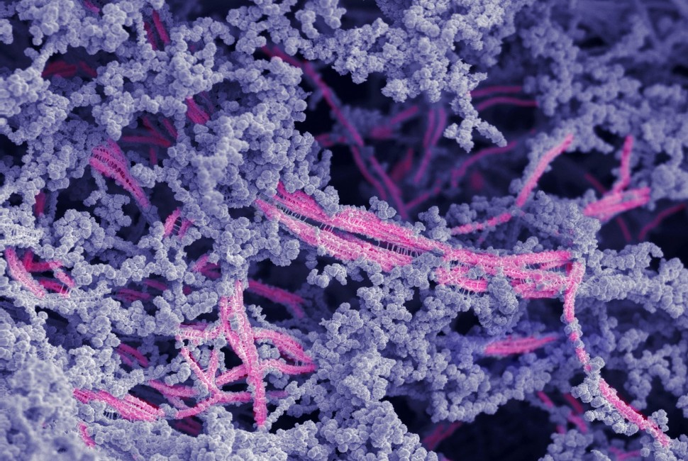 Crean un biomaterial que regenera totalmente el cartílago dañado de las articulaciones
