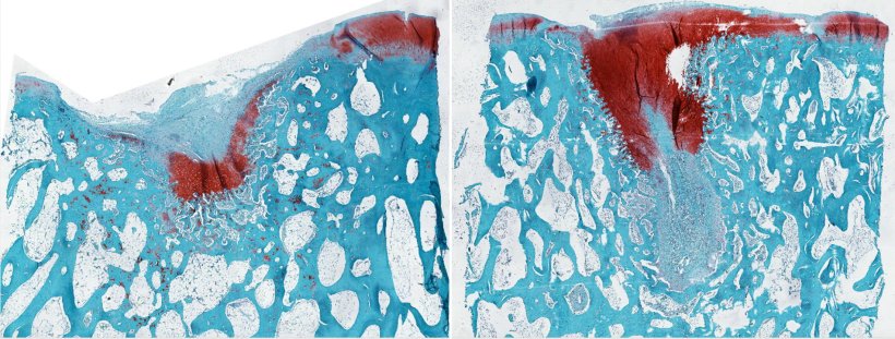 Crean un biomaterial que regenera totalmente el cartílago dañado de las articulaciones
