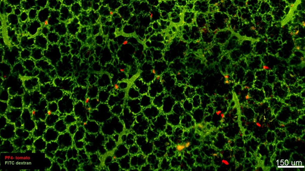 Los pulmones demuestran tener otra sorprendente función: producir sangre