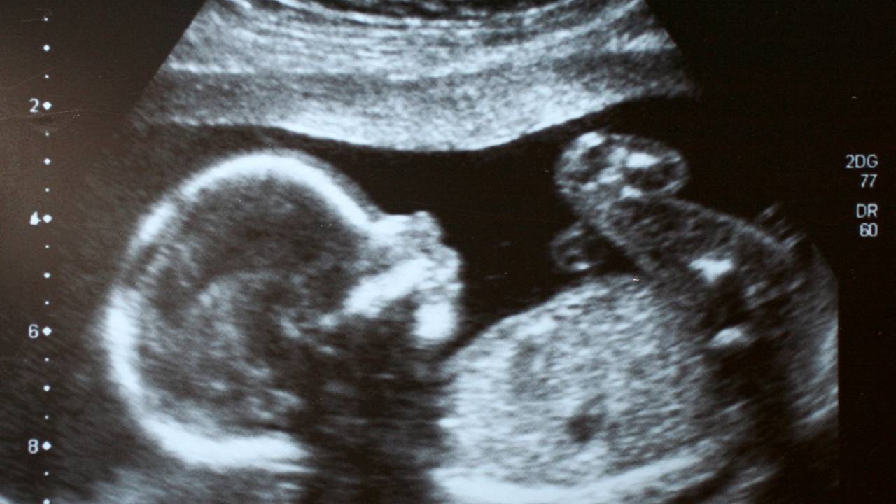 Bebé se convierte en el primer humano que recibe tratamiento para rara enfermedad genética aún estando en el útero