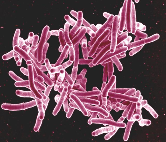 Una de las enfermedades infecciosas más mortíferas conocidas por el hombre ha sido revivida