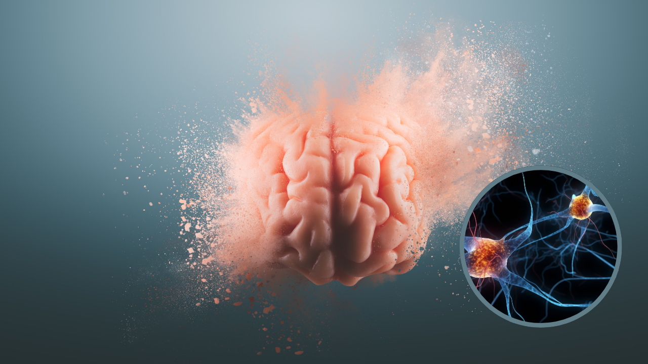 cerebro